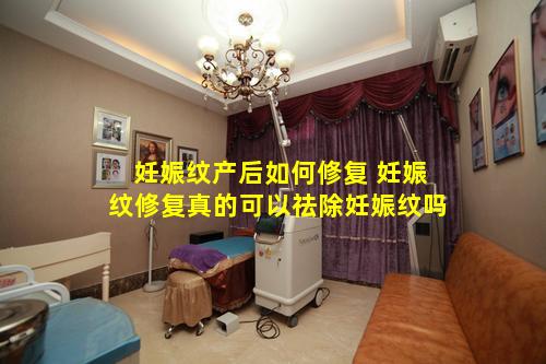 妊娠纹产后如何修复 妊娠纹修复真的可以祛除妊娠纹吗